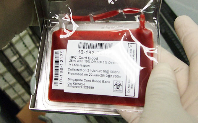 SCBB Cord Blood Unit