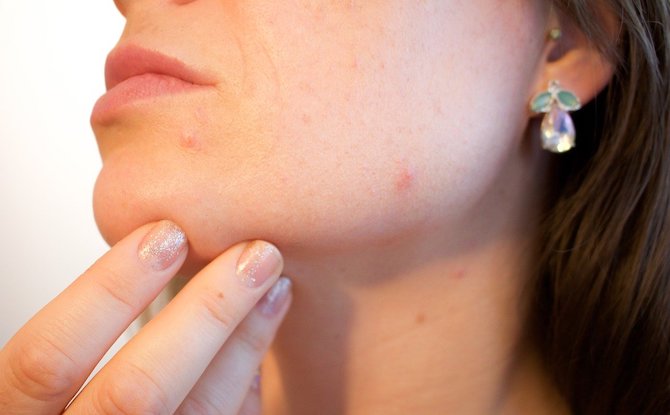 Skincare Routines: Dos and Don’ts For Healthier Skin 4 Skin care routine - Use overly rich products
